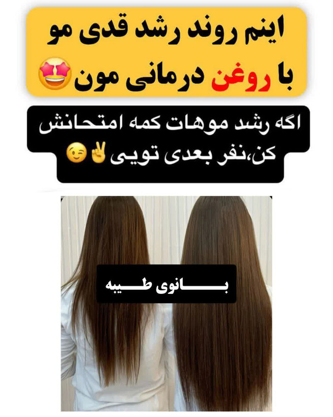 پرپشتی ریش و سببیل با تونیک دوقلو اکسونیک تحت لیسانس المان با اپلیکاتور