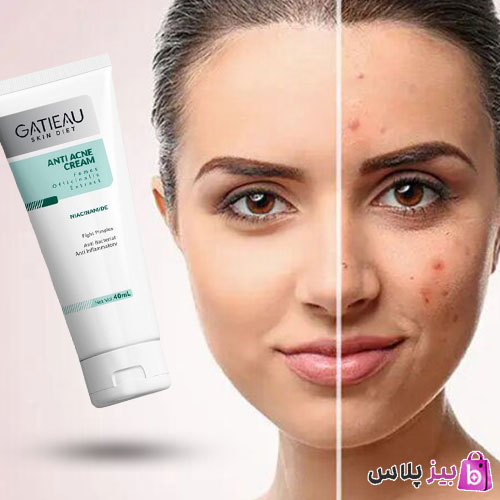 کرم  بیوممتیک ژلی آنتی آکنه ضدجوش و ضدلک ۴۰ میل  گاتیو ایتالیا