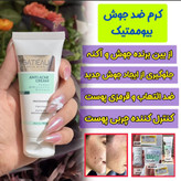 رفع لک و اکنه و جوش با دو محصول ژل انتی اکنه گاتیو و ژل شست و شو ویتابلا